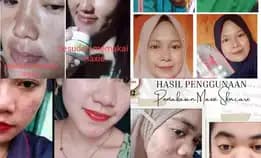 Maxie Skincare Terlarisss