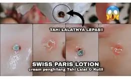 ????? ????? Lotion / Penghilang Tahi Lalat, Kutil, Mata Ikan, Dan Keloid