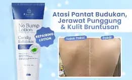 No Bump Lotion / Lotion Tubuh Kulit Bruntusan, Jerawat Punggung & Chicken Skin 100ml