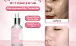 Serum Jerawat By Glawfyskin Bpom