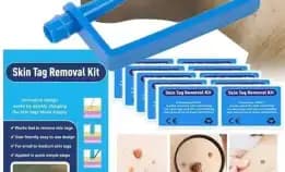 Skin Tag Removal Kit Skin Tag Remover Wart Remover Obat Kutil Penghilang Wart Removal Kit High Quali