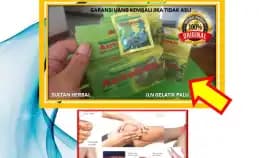 0878-8005-8622 Obat Asam Urat Yang Paten Di Kota Palu