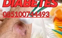 085100744493 Paket Hemat Perawatan Luka Diabetes Di Semarang, Harga Bersahabat!