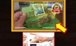 Wa: 0878-8005-8622 Obat Asam Urat Untuk Lansia Di Kota Palu