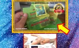 0878-8005-8622 Obat Sakit Ngilu Pada Tulang Kaki Di Kota Palu