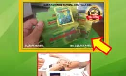 0878-8005-8622 Obat Asam Urat Allopurinol Di Kota Palu