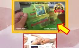 0878-8005-8622 Obat Asam Urat Apa Ya Di Kota Palu