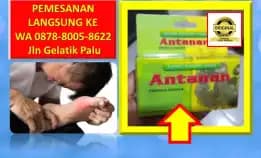 Wa: 0878-8005-8622 Obat Asam Urat Minumnya Kapan Di Kota Palu