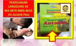 0878-8005-8622 Obat Asam Urat Kaki Bengkak Dan Nyeri Di Kota Palu