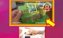 0878-8005-8622 Obat Asam Urat Terbaik Di Dunia Di Kota Palu