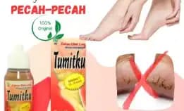 𝗕𝗣𝗢𝗠 Tumitku Obat Kaki Pecah Pecah 100% Original Solusi Kaki Kapalan Kering Kalus