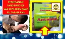 0878-8005-8622 Obat Asam Urat Pada Kaki Di Kota Palu