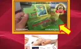 0878-8005-8622 Obat Asam Urat Jsr Di Kota Palu