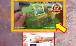 0878-8005-8622 Obat Asam Urat Yang Bengkak Di Kota Palu