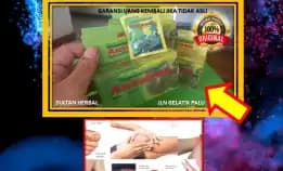 0878-8005-8622 Obat Asam Urat Untuk Kaki Bengkak Di Kota Palu