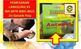 0878-8005-8622 Obat Asam Urat Resep Zaidul Akbar Di Kota Palu